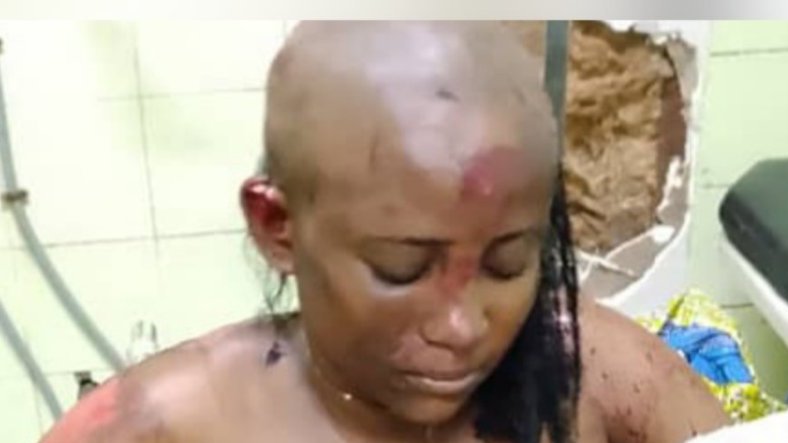 Insécurité à Libreville&nbsp;: une jeune femme victime d’une agression violente