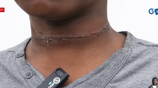 Violences sur mineur au PK18&nbsp;: une mère arrêtée, l’enfant pris en charge